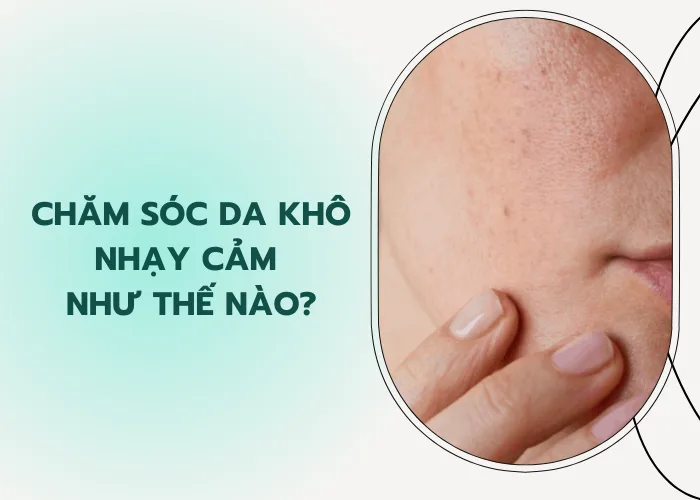 chăm sóc da khô nhạy cảm