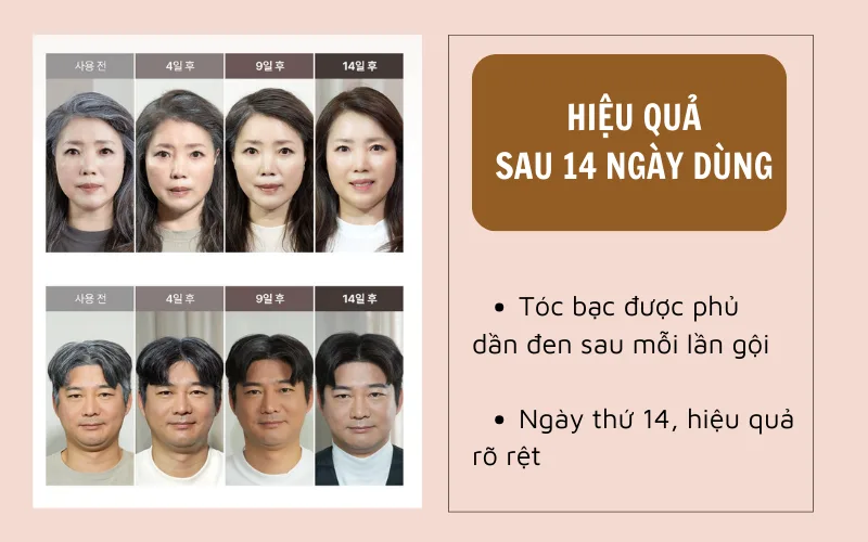 Dầu gội KioSkin