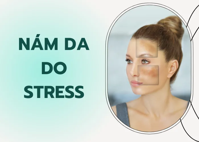 Nám da do stress