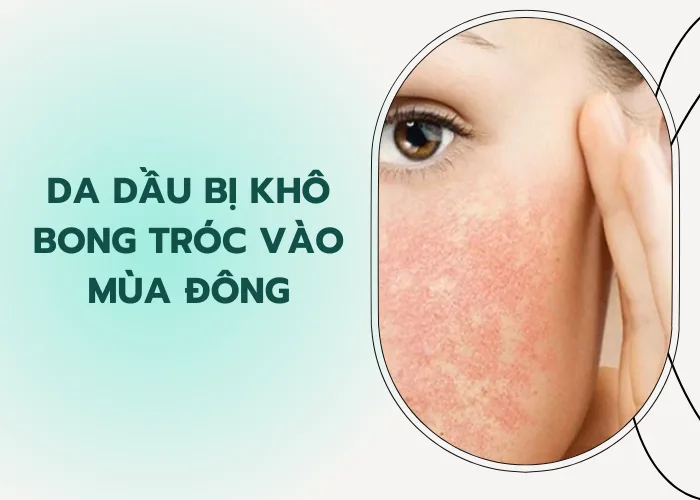 da dầu bị khô bong tróc vào mùa đông
