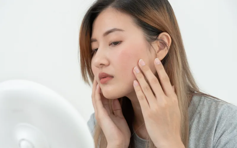 Kem chống nắng cho da nhạy cảm