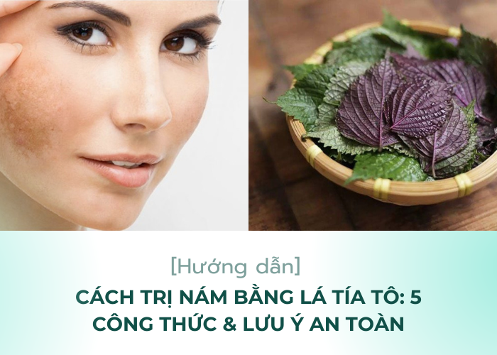 Cách trị nám bằng lá tía tô