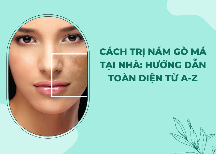cách trị nám gò má tại nhà
