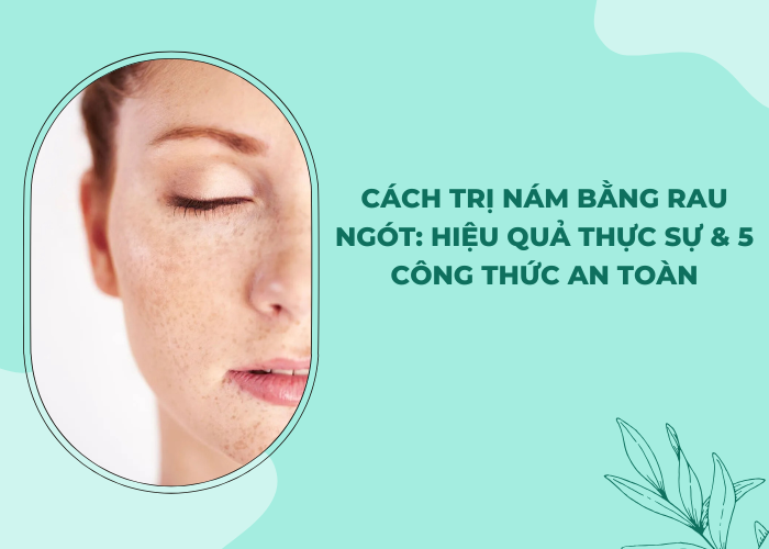 cách trị nám da tại nhà hiệu quả nhất