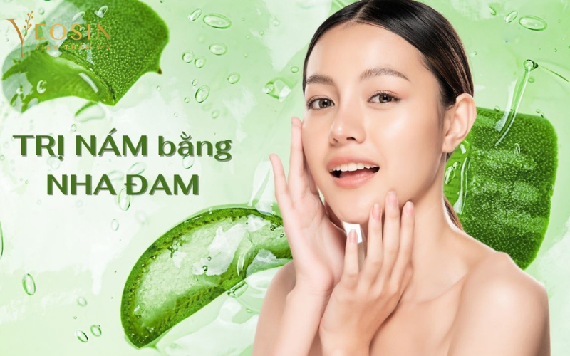 cách trị nám da mặt tại nhà
