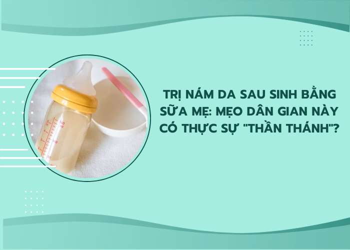 trị nám da sau sinh bằng sữa mẹ