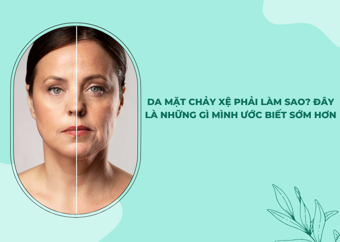 Da mặt chảy xệ phải làm sao