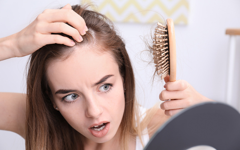 rụng tóc do stress