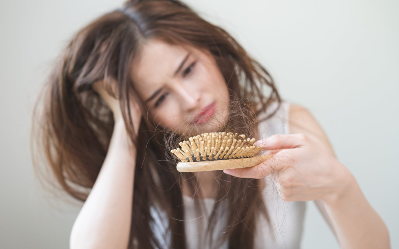 rụng tóc do stress
