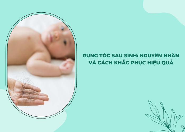 Rụng tóc sau sinh